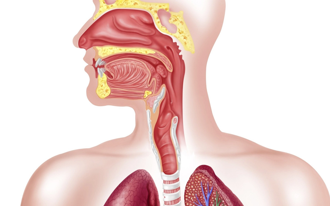 Заболевания верхних дыхательных путей как внепищеводные проявления гастроэзофагеальной рефлюксной болезни: современное состояние проблемы