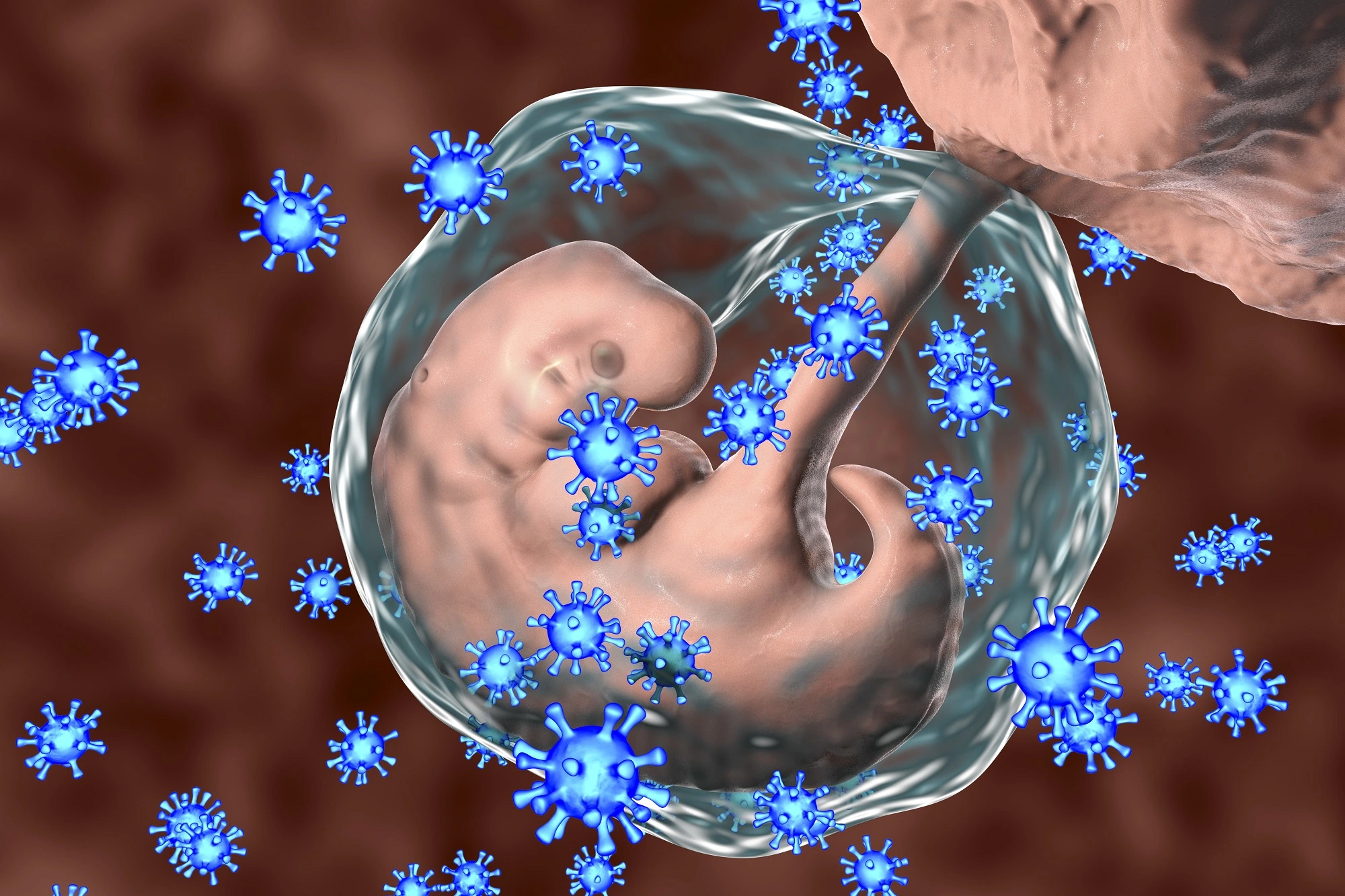 Поражения органов и систем у детей, родившихся от матерей с острой цитомегаловирусной инфекцией