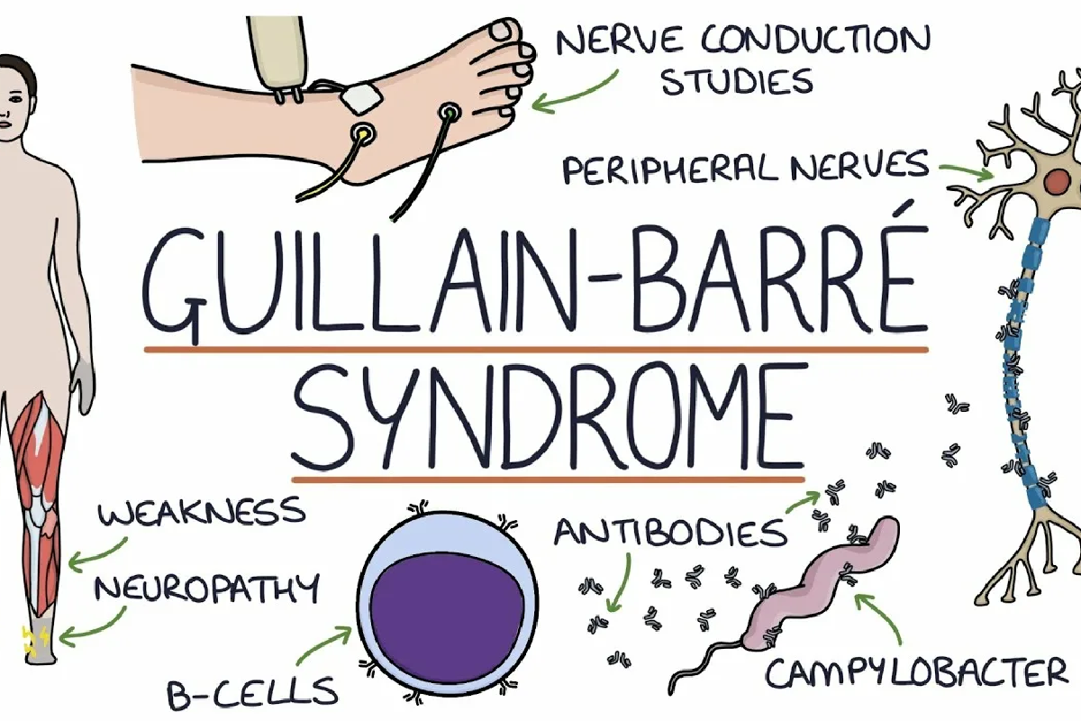 Клинический случай синдрома Барде-Бидля, диагностированного у взрослого