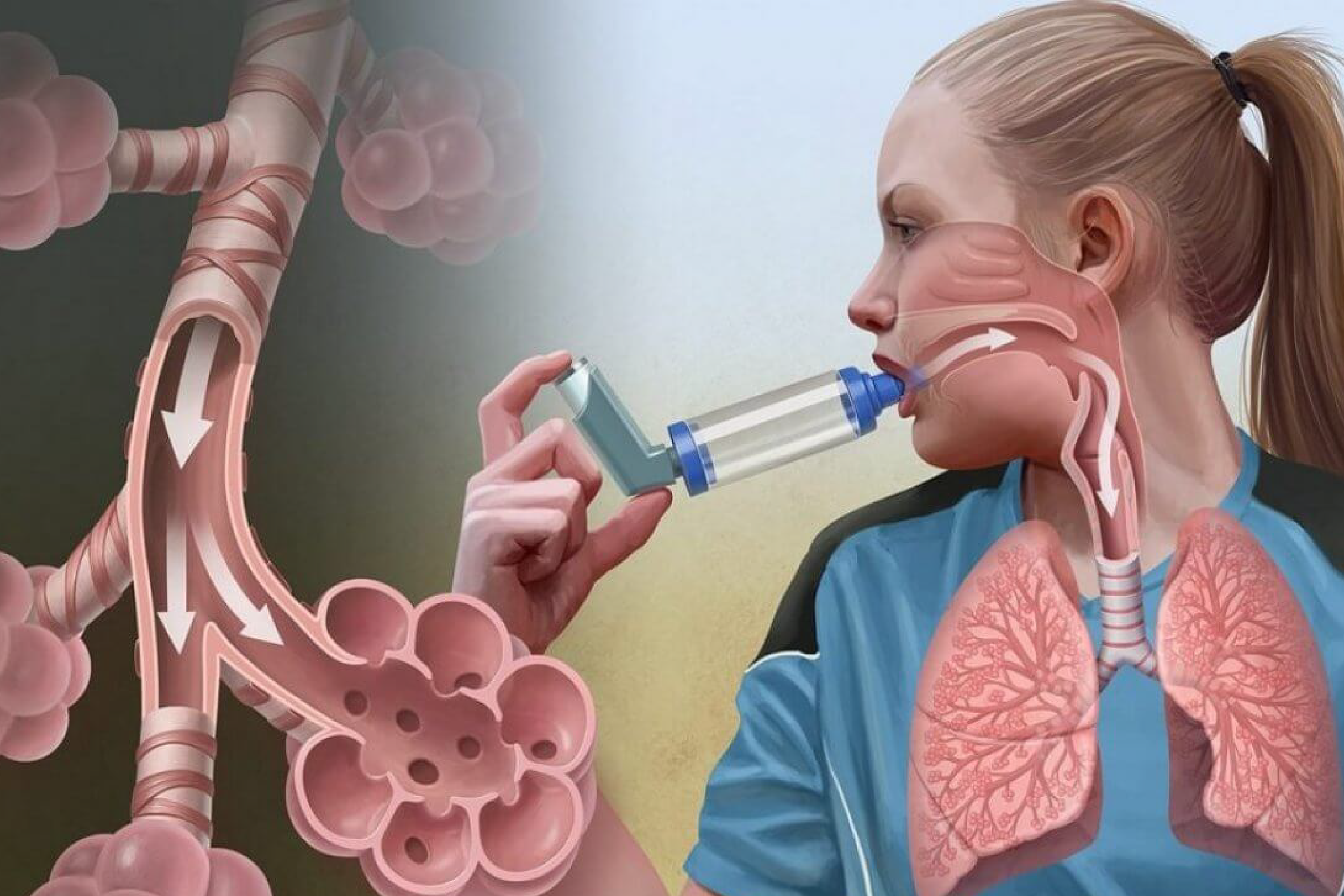 Атопическая бронхиальная астма — актуальная проблема современной медицины