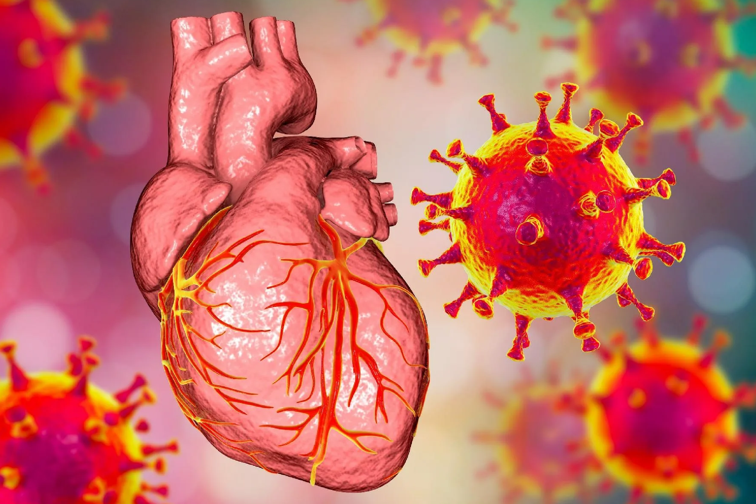 Вирусный эндомиокардит у взрослого пациента